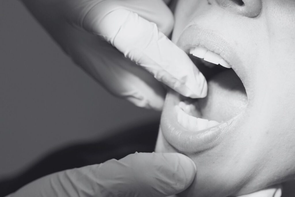 implantologia tratamiento de fracasos implantarios