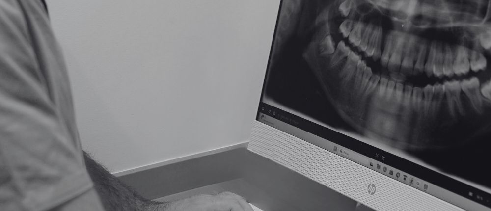 zsm implantologia radiografia horizontal